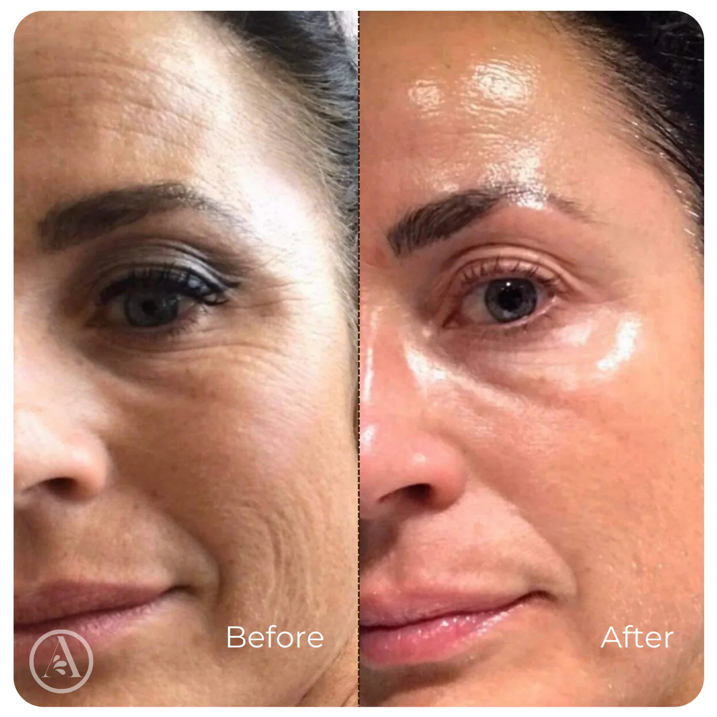 Wrinkle-Smoothing Collagen Serum