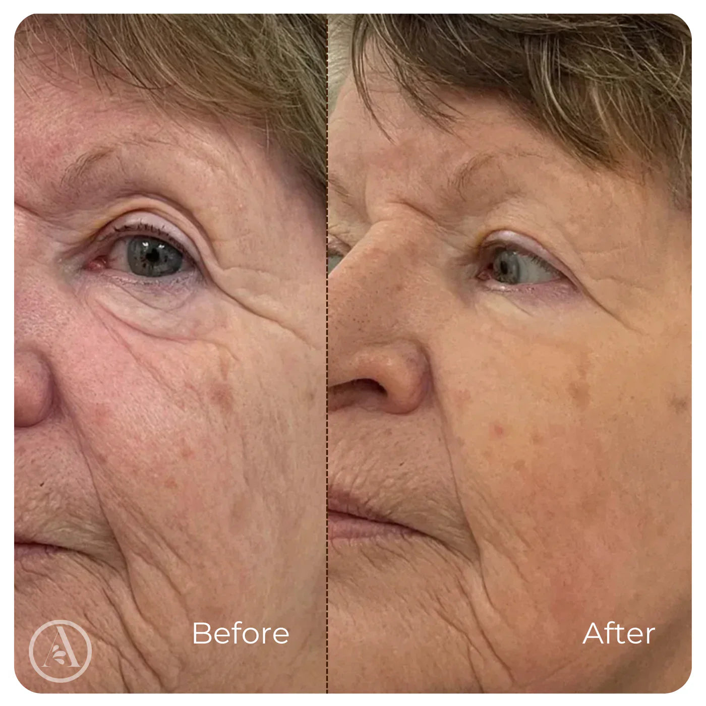 Wrinkle-Smoothing Collagen Serum