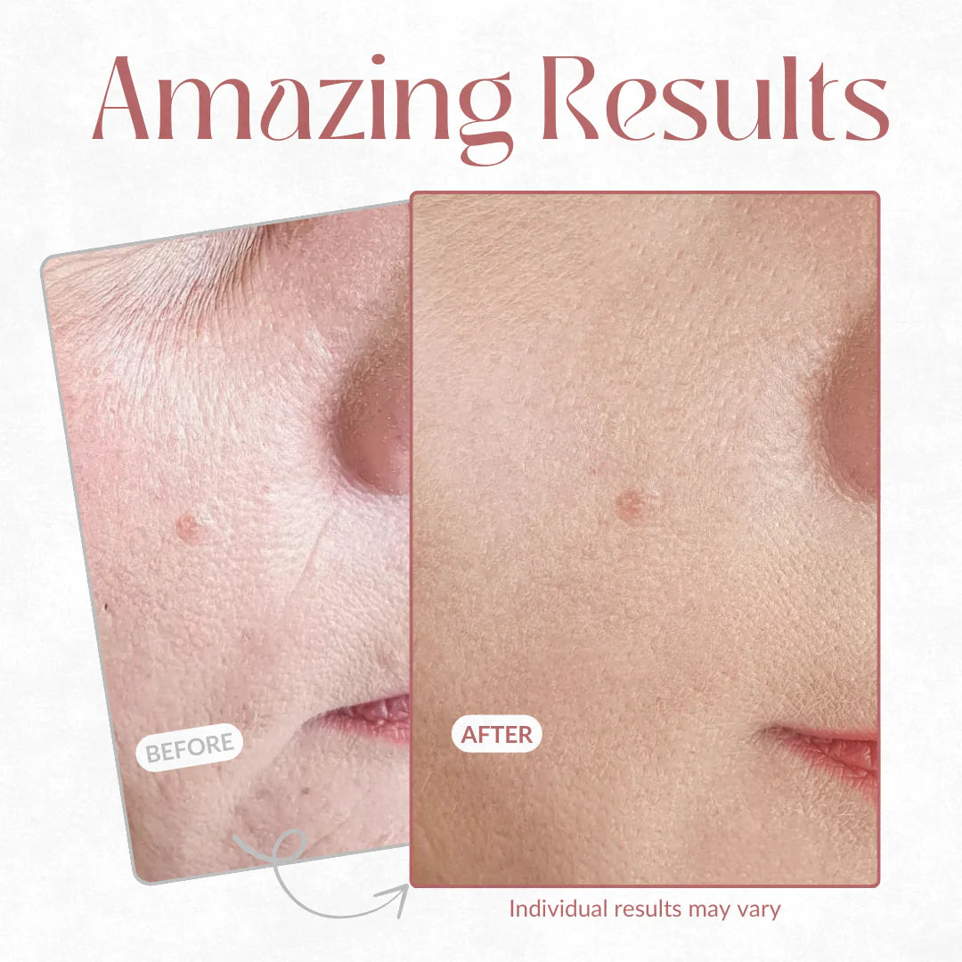 Line Smoother™ Primer