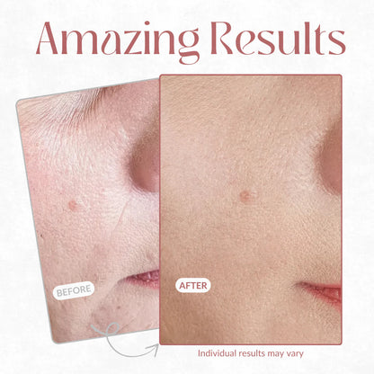 Line Smoother™ Primer