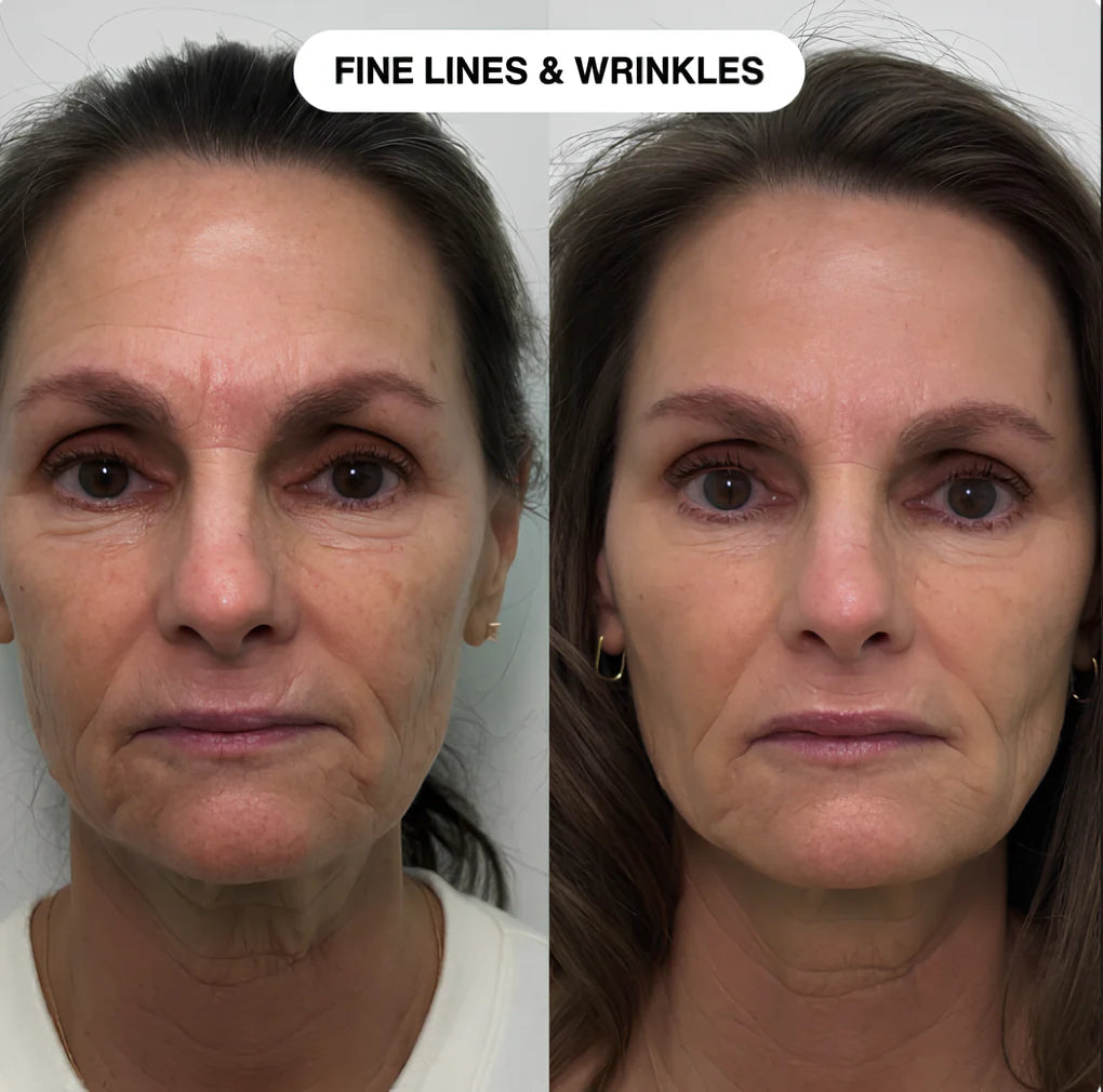 Line Smoother™ Primer