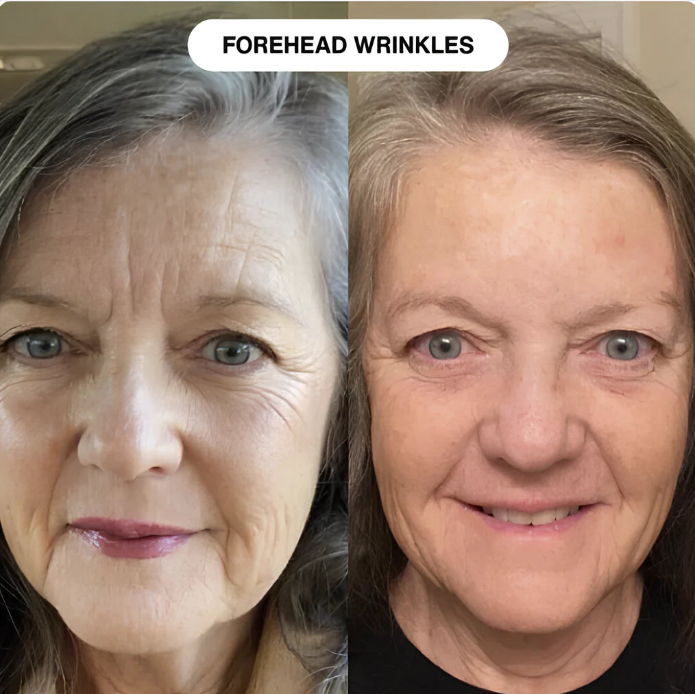 Line Smoother™ Primer