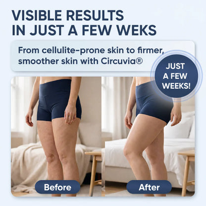 Anti-Cellulite SculptPro