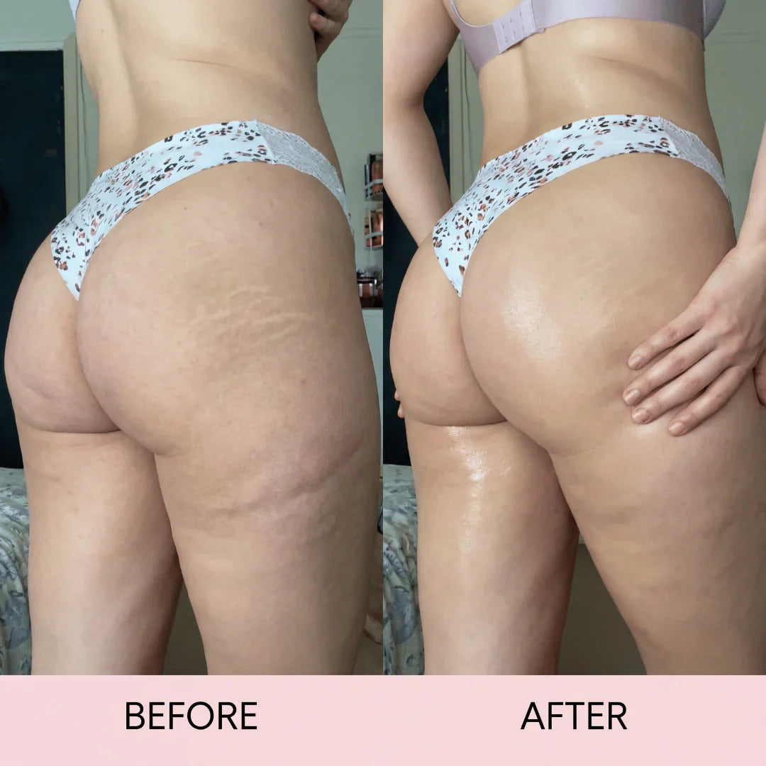 Cellulite Massage Oil