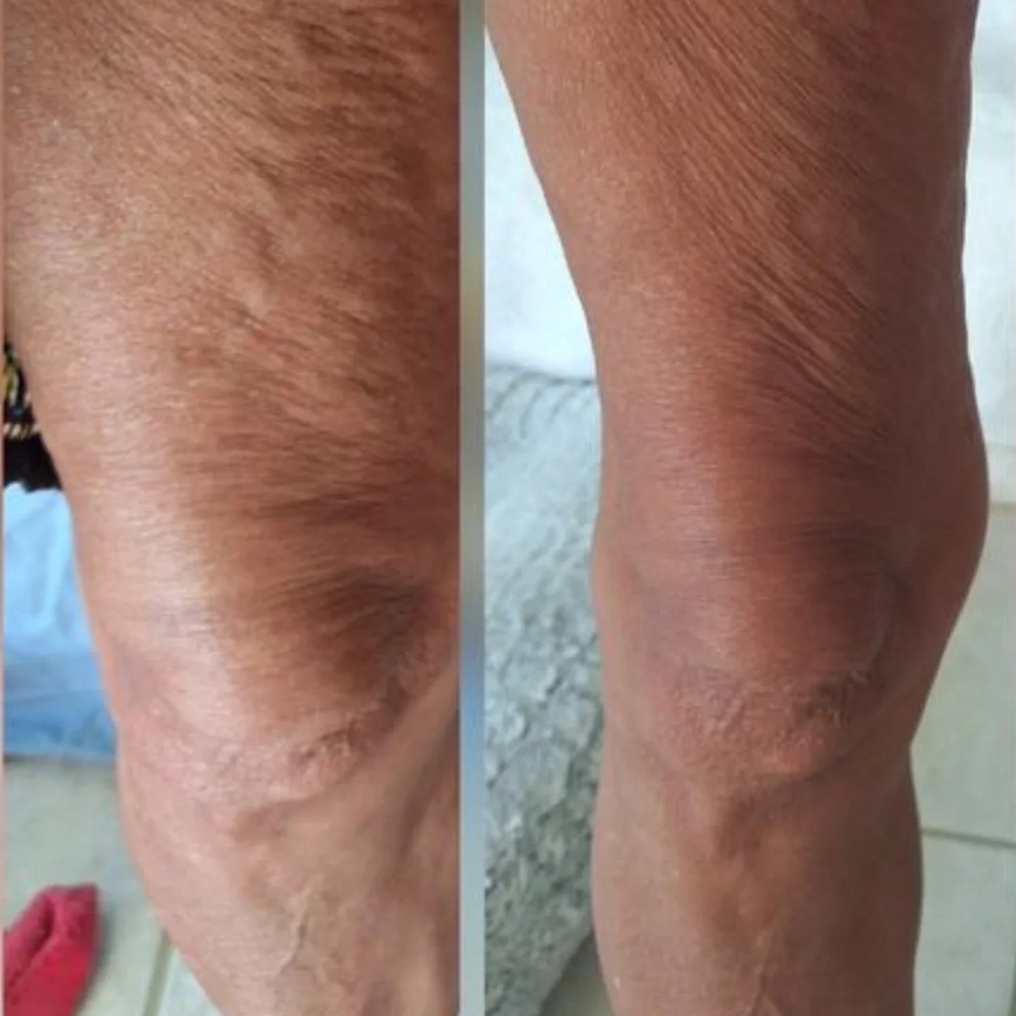 Cellulite Massage Oil