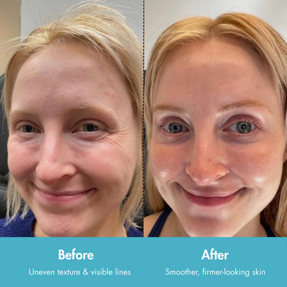 Collagen Lift Cream-Serum