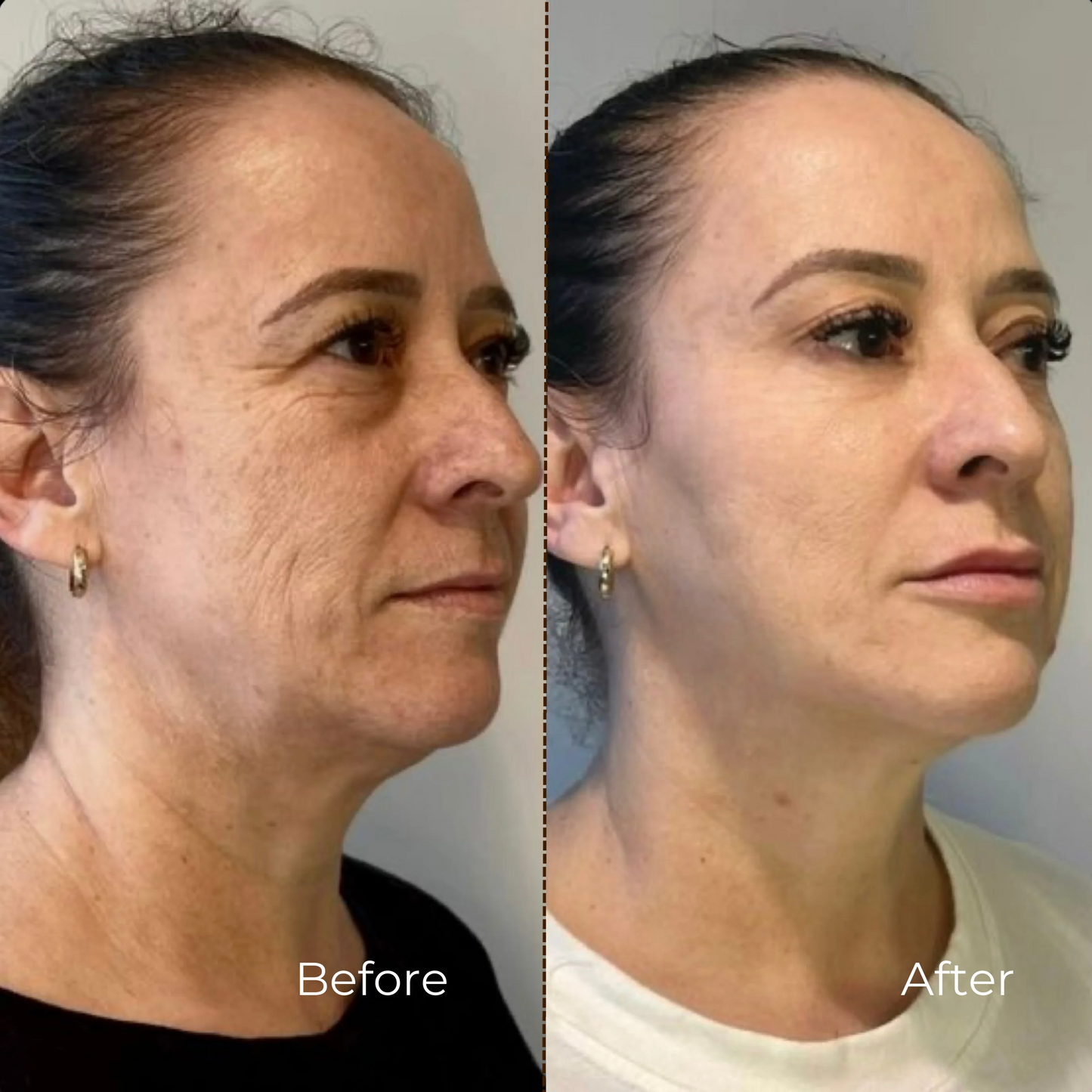 Collagen Lift Cream-Serum