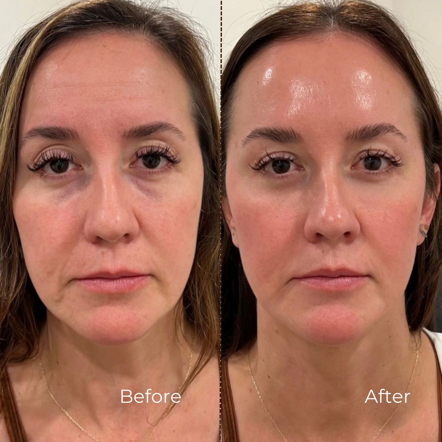 Collagen Lift Cream-Serum